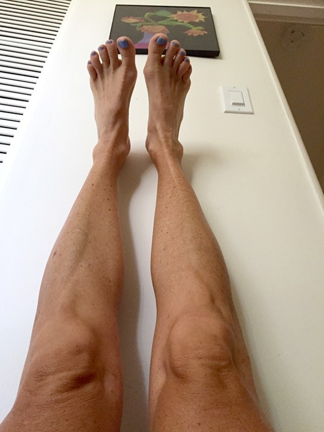 RecoveryLegs